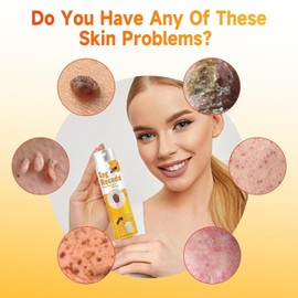 Lmuwecno 2pcs Ta-g Recede Bee Venom Spray - Moisturizing Bee Venom Spray for Women and Men (20 ml)