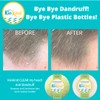 KinKind Shampoo Bar - CLEAR My Head! Anti Dandruff Shampoo