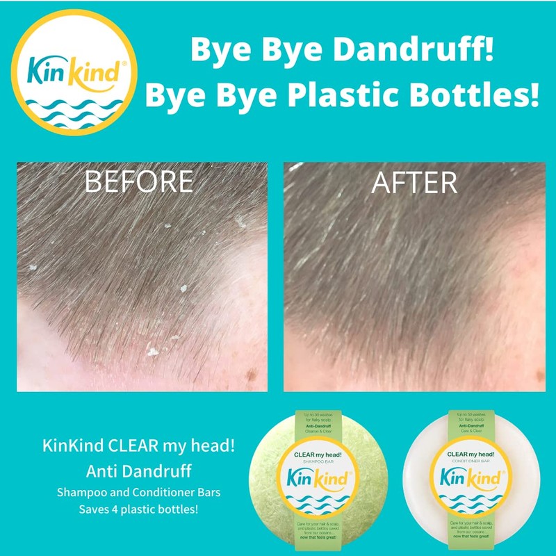 KinKind Shampoo Bar - CLEAR My Head! Anti Dandruff Shampoo