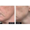 Kleem Suero De Vitamina C Ácido Hialurónico Para Cara Y