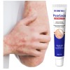 Crema De Tratamiento Psoriasis Para Picazón Y Escamosa