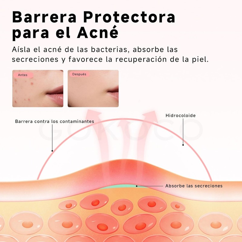 GOKOCO Parches para Acné 306 Pack, Estrella Brillante de 6