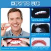 Dientes Postizos Moldeables Carillas Dentales