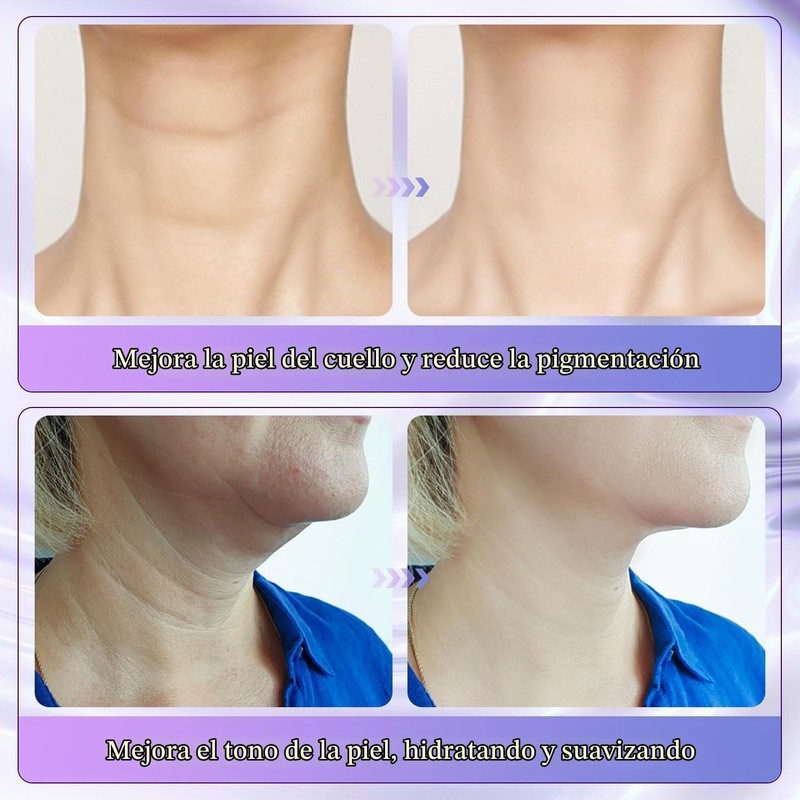 Crema Reafirmante de Cuello con Masaje de Rodillos 2 en