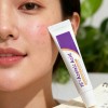 Azelaic Acid Cream, Serum With Azelaic Acid Al