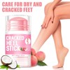 Anti-Cracking Cream, For Dry Cracked Feet And Hands, Prevent From