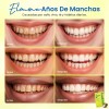 Freshmile Tiras Blanqueadoras Dentales Sensibles