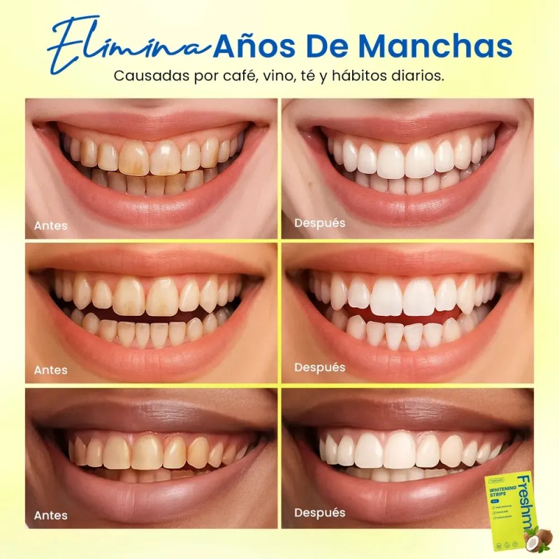 Freshmile Tiras Blanqueadoras Dentales Sensibles