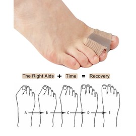 Golbylicc Bunion Toe Separators for Overlapping Toes Women Men, Gel Toe Spacers Bunion Corrector with 2 Loops for feet (4PC)