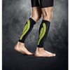 Select Kompressions-Wadenbandage, XS, schwarz, 5615000111