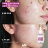 Handmade Heroes 2% Bakuchiol Oil Lifting and Firming Oil for