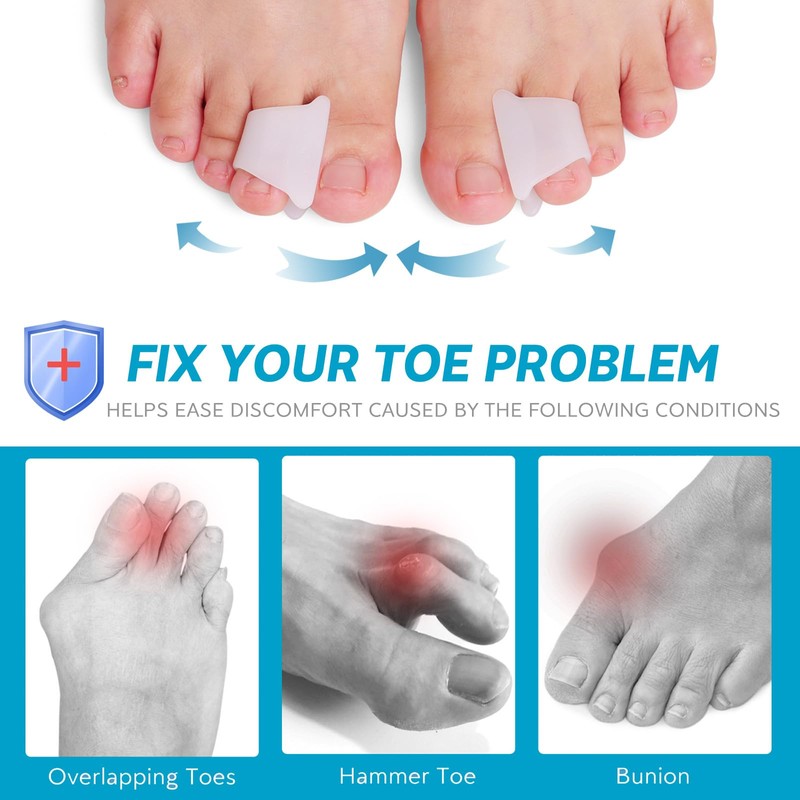 Nolimvita Hammer Toe Straightener Corrector - Toe Spacers Toe Splints