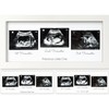 KeaBabies Baby Sonogram Picture Frames - Trio Ultrasound Picture Frames,