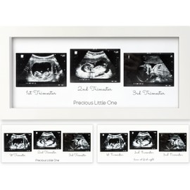 KeaBabies Baby Sonogram Picture Frames - Trio Ultrasound Picture Frames, First Time Mom Gift, Cute Pregnancy Reveal Photo Frame, Baby Gender Reveal Gift, Newborn Nursery Decor (Alpine White)