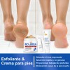 Set Crema Y Exfoliante Para Pies Con Urea 40% Y