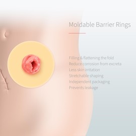 DERAYMI 30 Pack Moldable Ostomy Barrier Rings, 4mm Thickness Barrier Rings for Ostomy Bags, Sting-Free Hydrocolloid Ileostomy Elastic Ostomy Rings Secure Seal for Colostomy Bags