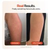 Strawberry® Crema Rejuvenecedora Para Queratosis Pilaris Kp