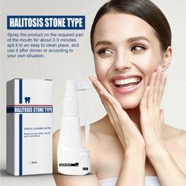 Mnozreo Zahnaufhellendes Mundspray,Zahnstein Löst Mundspray,Zahnsteinfrei Auflösendes Zahnspray,Zahnstein Zahnreinigungsspray,Zahnstein Entfernen Löst Mundspray Auf,Zahnsteinfrei Zahnspray,30ML