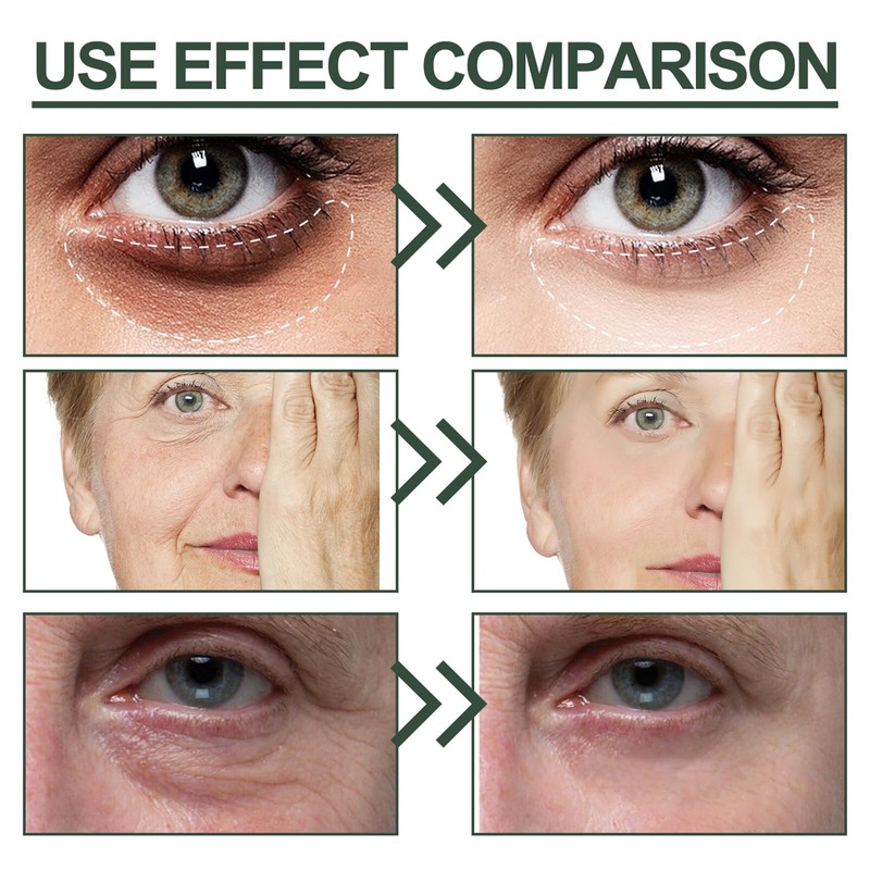 Eye Crème Anti-age Eye Cream, Instant Eye Lift Lisser Les