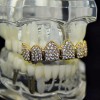 Best Grillz 18k Gold Plated Grillz CZ Simulated Iced Bling