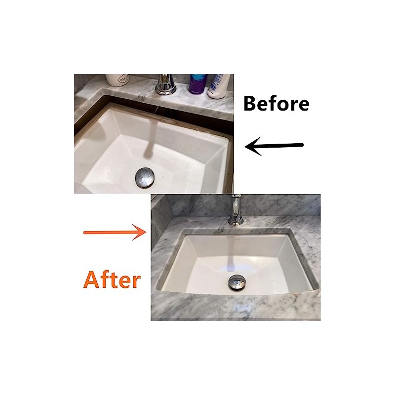Complete Sink Repair Kit System-Undermount Sink Installation Kit- Bracket for
