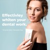 Venneir® Professional Toothpaste for Veneers, Implants, Bonding, Crowns & Natural