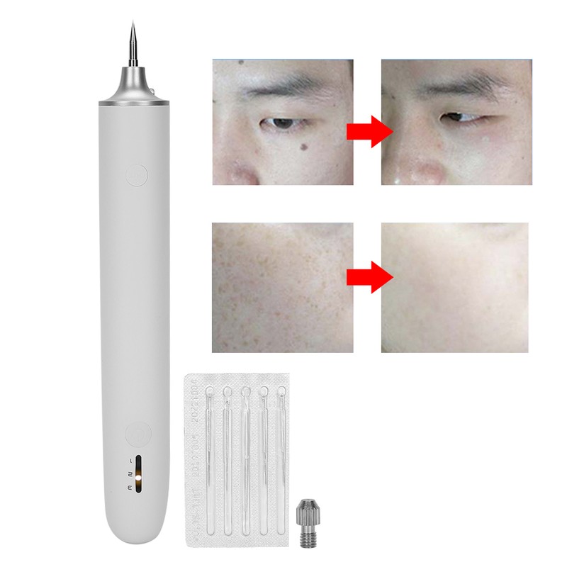 Mole Removal Pen USB 3 Gears Adjustment Freckle Spots Removal