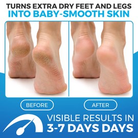 Foot Balm Blue - Cream for dry skin - For dry feet - Dry and Cracked Feet - Rosemary & Eucalyptus - 150ML - Imperial feet