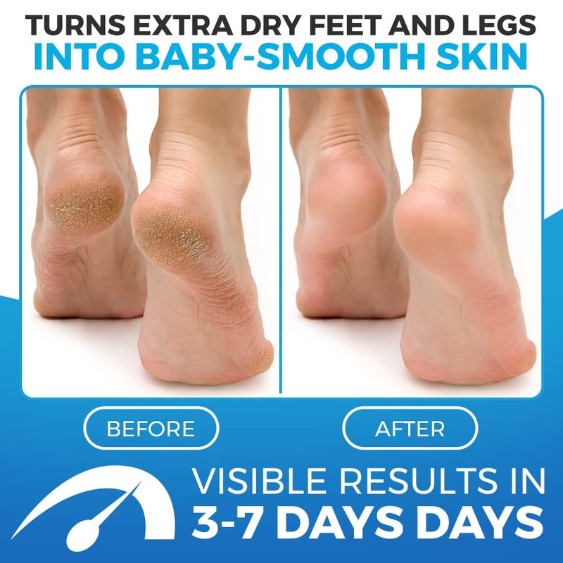 Foot Balm Blue - Cream for dry skin - For