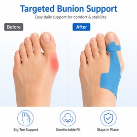 Precut Kinesiology Tape for Bunion Support – 10 Breathable Cotton Strips for Comfortable Daily Big Toe Support