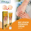 Wellness South Moon Anti-Itch Bee Venom Psoriasis Cream Cooling Soothing