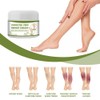 Varicose Veins Cream Natural Ointment for Varicose and Spider Veins