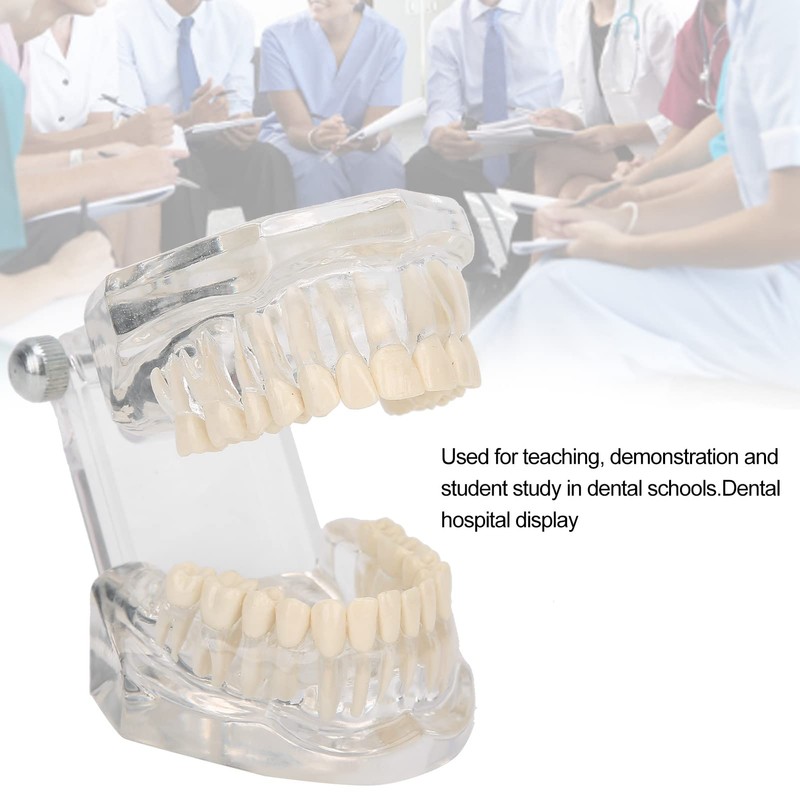 Dental Model, Transparent Acrylic Dental Teeth Model, Simulation Mouth Model,