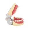 Periodontal Disease Teeth Resin Model Dental Demonstration Teeth Model for