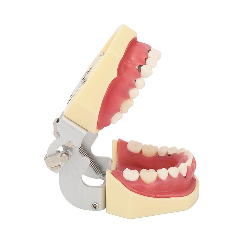 Periodontal Disease Teeth Resin Model Dental Demonstration Teeth Model for