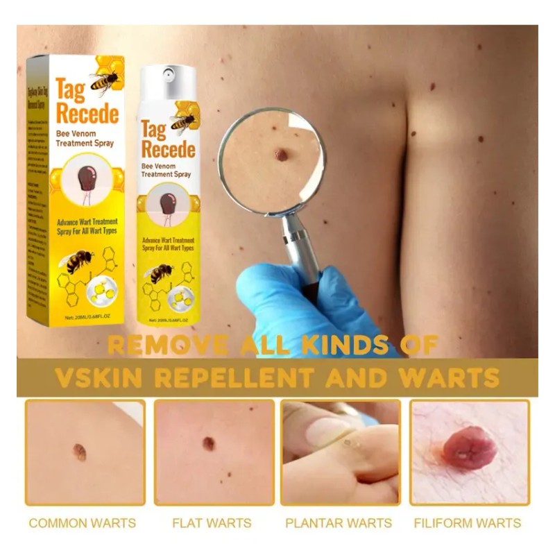 2* Crema Eliminadora De Verrugas Trivializa La Piel Y Las