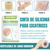 2 Rollos Cinta Silicona Reparación Cicatrices Marcas Piel Silicona Suave