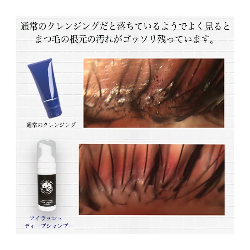 【Eye Pollen and Eyelash Mite Countermeasure】TV-Featured Eye Shampoo Foam Eyelash