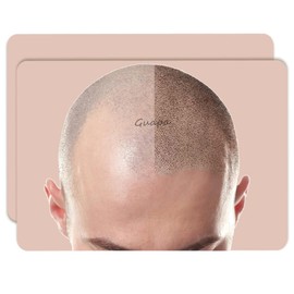 3pcs Scalp Micropigmentation Practice Skin Realistic Simulation SMP Rubber Practice Skin for Bald Micropigmentation Traning (Male Scalp Skin)