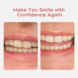 Unbranded 2 Set Dentures Fake Teeth DIY Kit Top and Bottom Dentures Temporary Fake Teeth