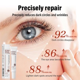 Retinol Eye Cream, Retinol Serum Eye Cream for Dark Circles and Puffy Eyes, Eye Cream with Retinol & AHA 30% & BHA 2% & Hyaluronic Acid for Fine Lines & Wrinkles Saggy Skin Puffy Eyes (2 PCS, 1)