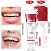Pack of 2 Sp-4 Toothpaste, Sp-4 Probiotic Toothpaste, Whitening Toothpaste,