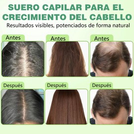 Hair Treatment Seru, Deja el Cabello Más Suave y Grueso