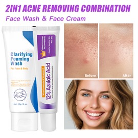 Acne Treatment Cream with Face Cleanser - Acne Treatment Kit for Spot Prone Skin - Dark Spot Remover for Face - Spot Treatment,Pimple Cream,Reduces Redness,Even Skin Tone (One Size-Anti Acne Set)