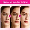 Txa Cream Crema Manchas Faciales Arbutin Aclaramiento Piel Oscuras Pecas