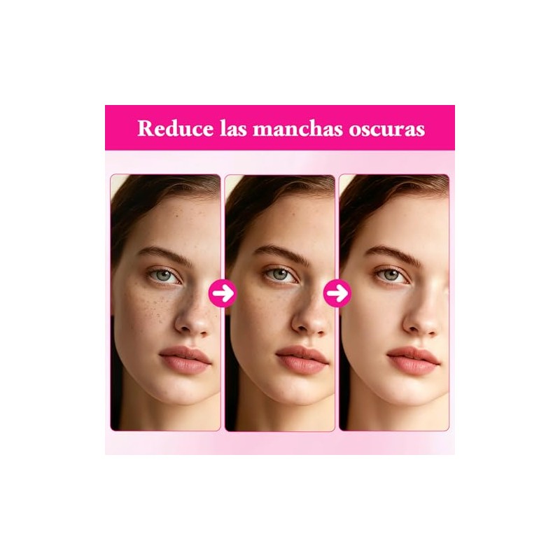 Txa Cream Crema Manchas Faciales Arbutin Aclaramiento Piel Oscuras Pecas