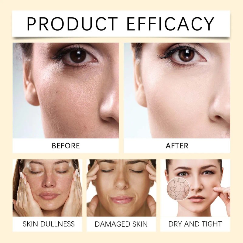 La Crema Para Ojos Reafirmante Y Antiarrugas H Reduce Las