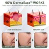 Luhaka Luhaka DermaEase Natureerase Instant Mole Spot Removal Gel,Purifying gel
