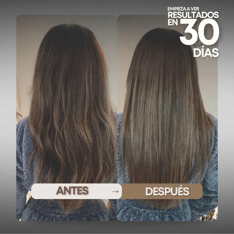 Vittale Kit 3 Pasos Crecimiento Reparador Cabello Lacio