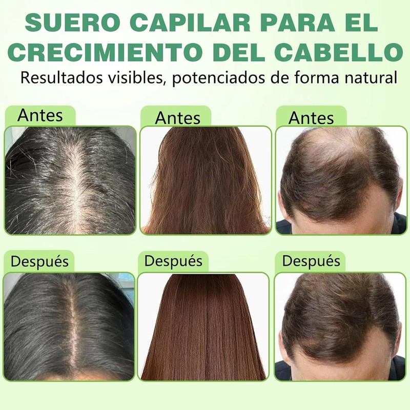 Hair Treatment Seru, Deja el Cabello Más Suave y Grueso